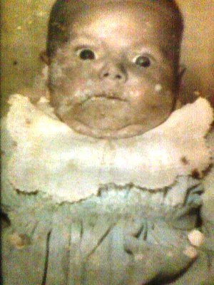 Fotos históricas - Foto 04 - Mefisto